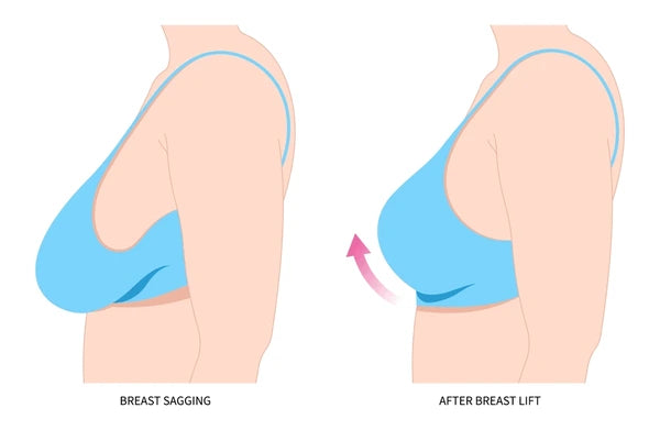 BREAST MAXX